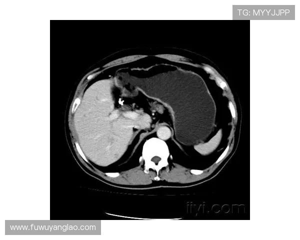 医学中b超中mt世界杯体育论坛